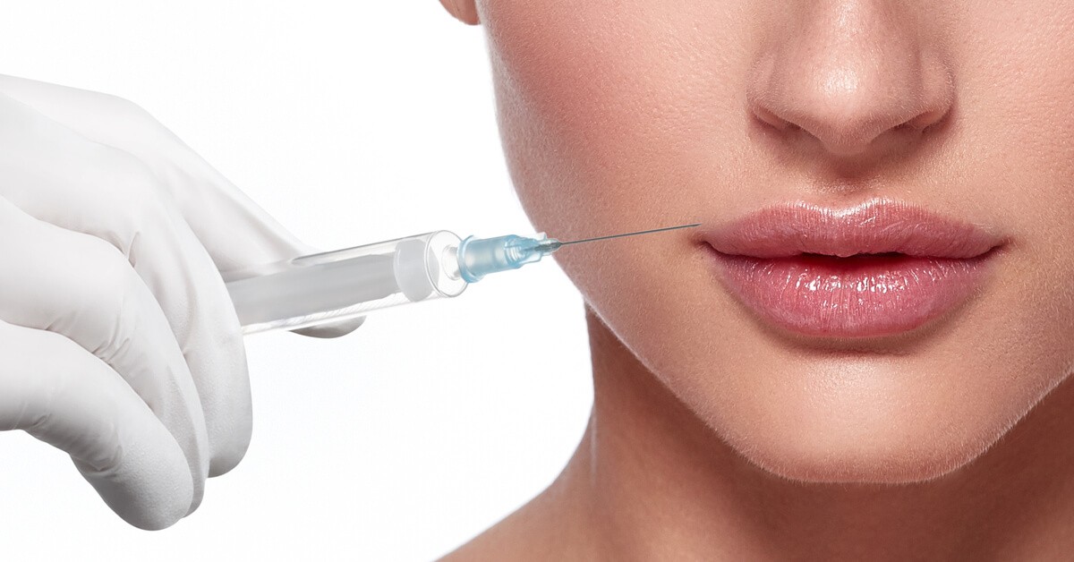 حقن فيلر الشفايف image