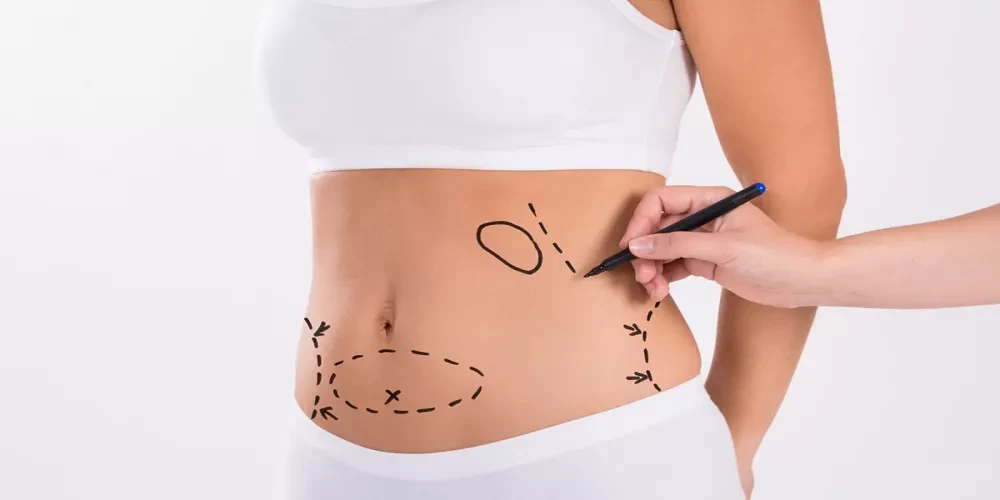 عمليات البطن والخصر image